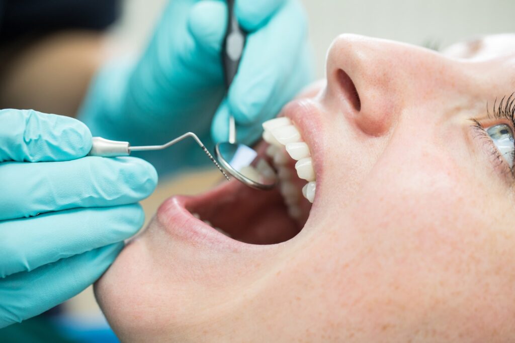 Emergency Dental Care - North Vancouver Dentist